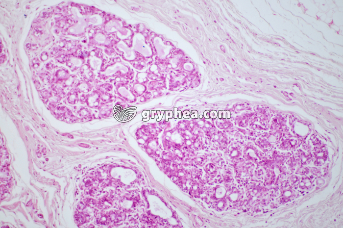 Glande mammaire active CT x40 - gryphea.com